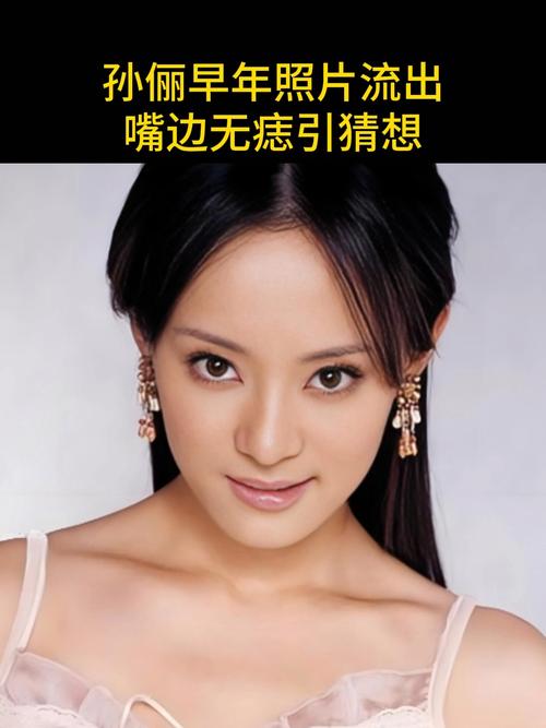 2025新澳门正版新澳免费资本和孙俪唇下痣没了与孙俪嘴唇的痣