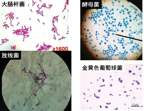 澳门研究生资料网站大全,和牛肉馅大肠杆菌污染与牛肉馅大肠杆菌污染大吗